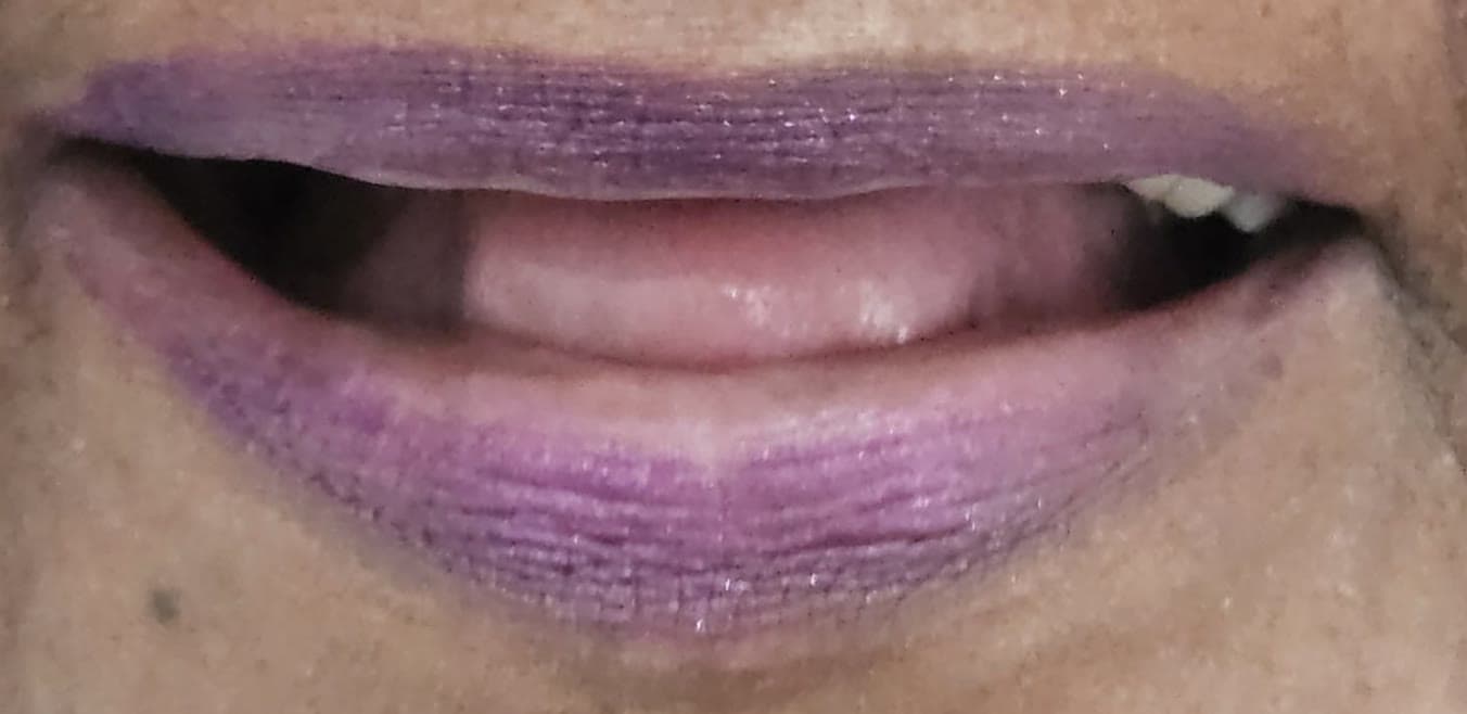 Close da boca antes: arcada superior sem dentes