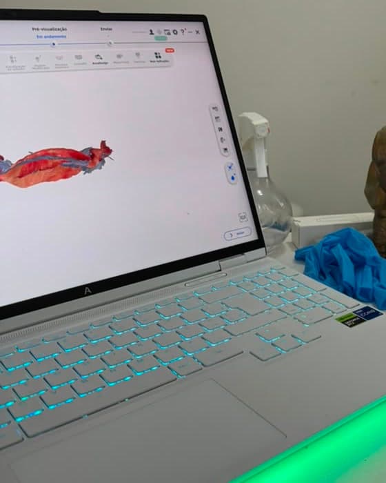 Notebook exibindo o modelo 3D de uma arcada logo após o escaneamento