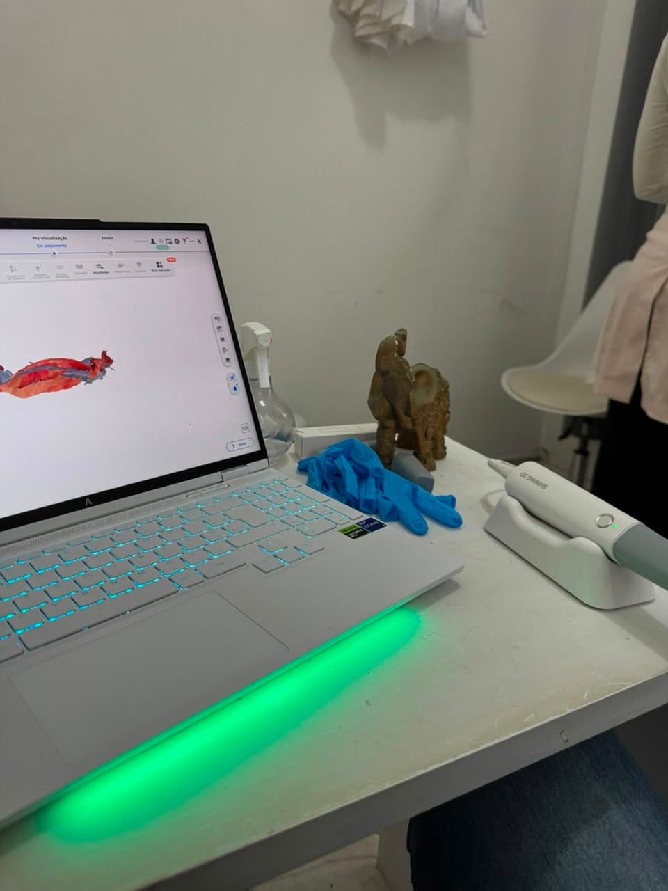 Estação de escaneamento digital: notebook com o modelo 3D da arcada e scanner intraoral