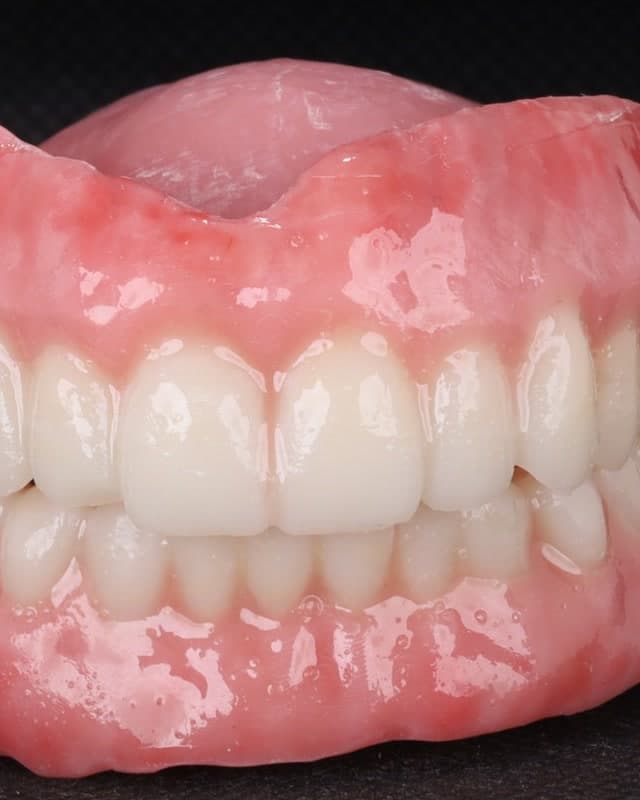 Detalhe dos dentes de uma prótese total produzida pela Dent3D
